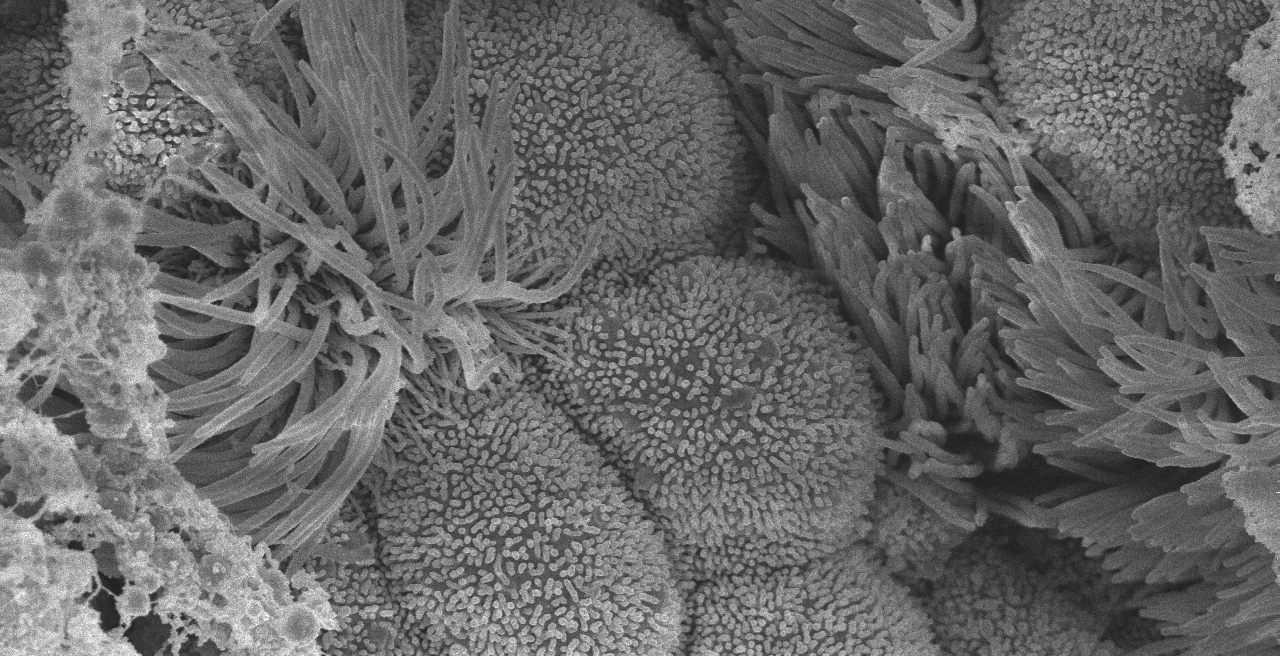 Targeting the Hillock for Gene Therapy